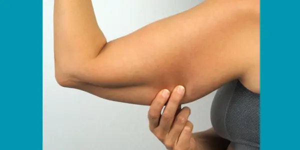 Arm Liposuction