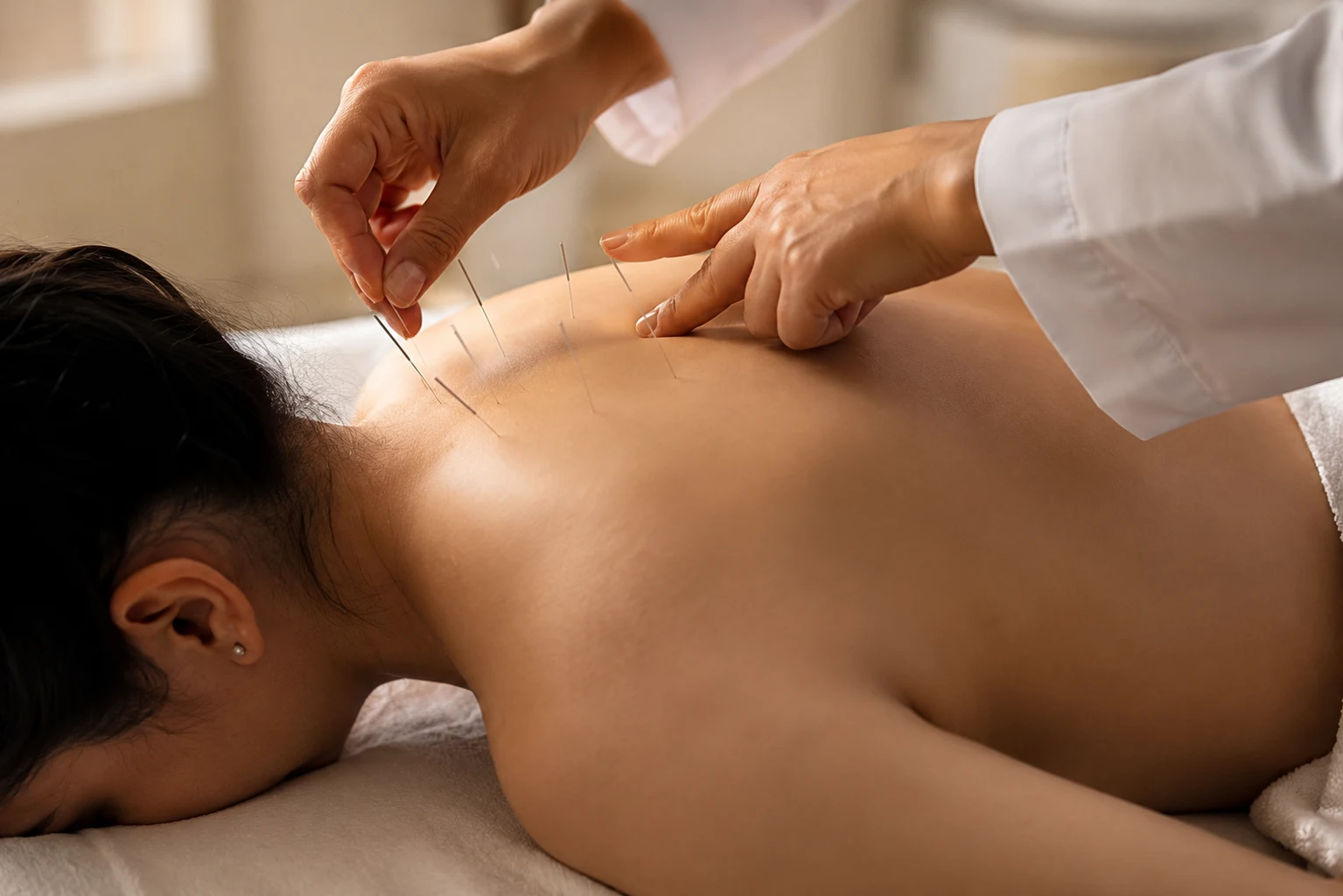 Acupuncture therapy